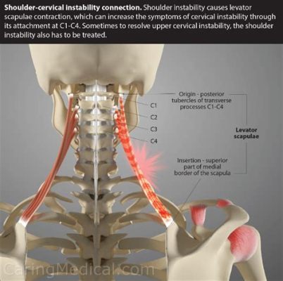 Can Running Cause Neck Pain? Exploring the Unexpected Connections Between Footsteps and Cervical Strain