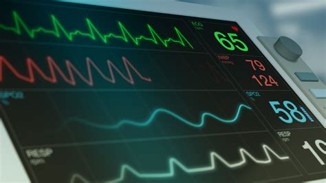 What is the Blue Line on a Hospital Monitor: A Journey Through the Labyrinth of Medical Imagery